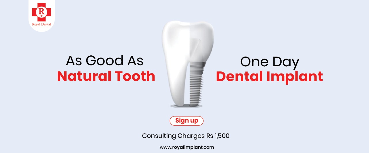 One Day Dental Implant